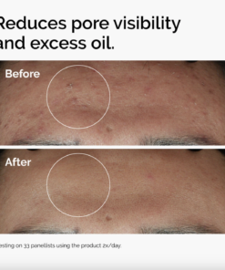 Niacinamide 10% + Zinc 1% 30 Ml - Image 3