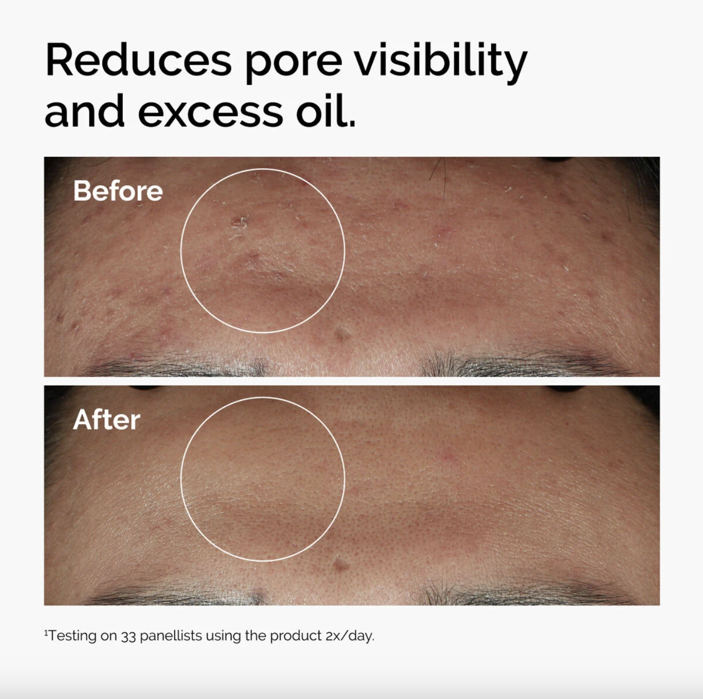 Niacinamide 10% + Zinc 1% 30 Ml - Image 3