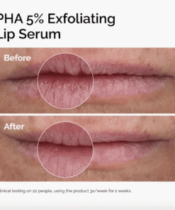 PHA 5% Exfoliating Lip Serum 15 Ml - Image 3