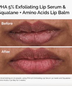 PHA 5% Exfoliating Lip Serum 15 Ml - Image 4