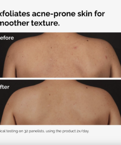 Salicylic Acid 0.5% body serum 240ml - Image 3